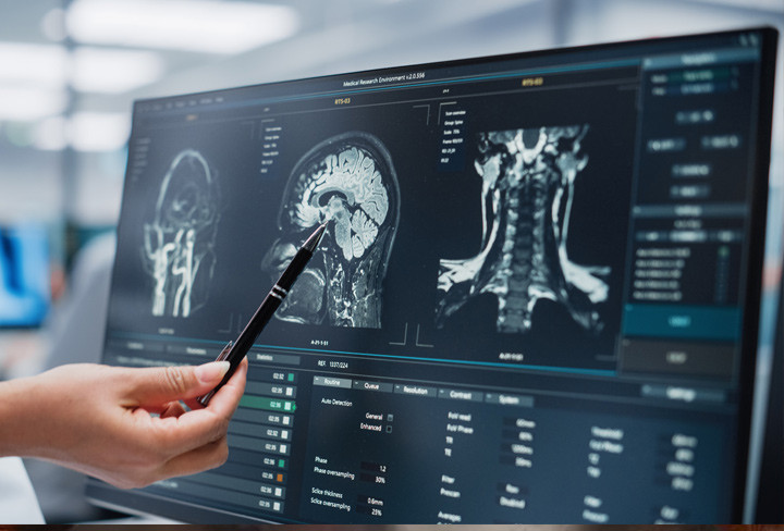 NEO100 Research Shows Impact On Recurrent Grade 4 Astrocytoma